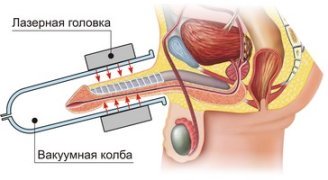 схема лод.jpg